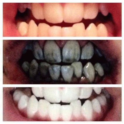 WhiteMaster Teeth Whitening Hampaiden Valkaisu 30g